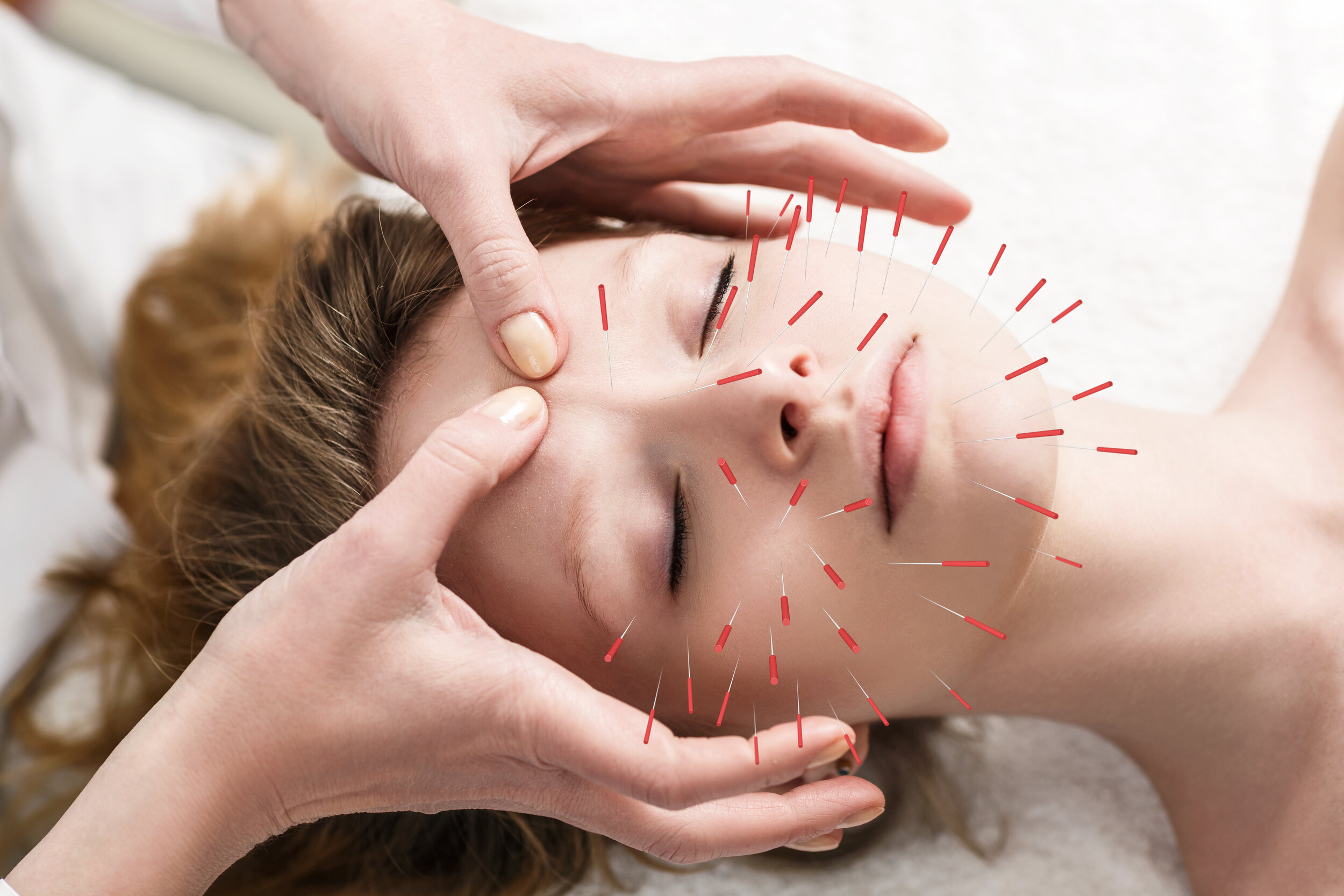 Kozmetik Akupunktur Hakkında Bilmeniz Gerekenler